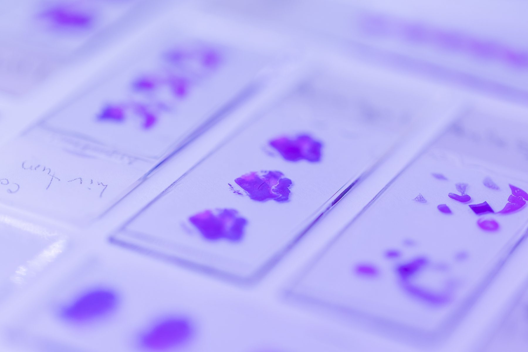 Macro of a petri dish and specimen under violet light
